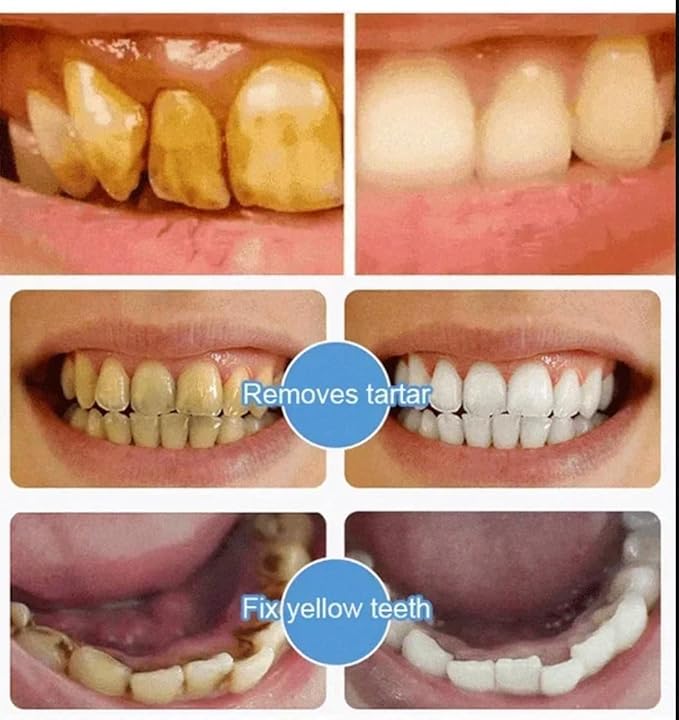 7.5 nHAP Hydroxyapatite Toothpaste - Nano Hydroxyapatite Whiteing Teeth | Enamel Repair | Fluoride-Free | Deep Cleaning Care Oral Health | Breath Freshening | Mild Mint | Sensitive Tooth (2)