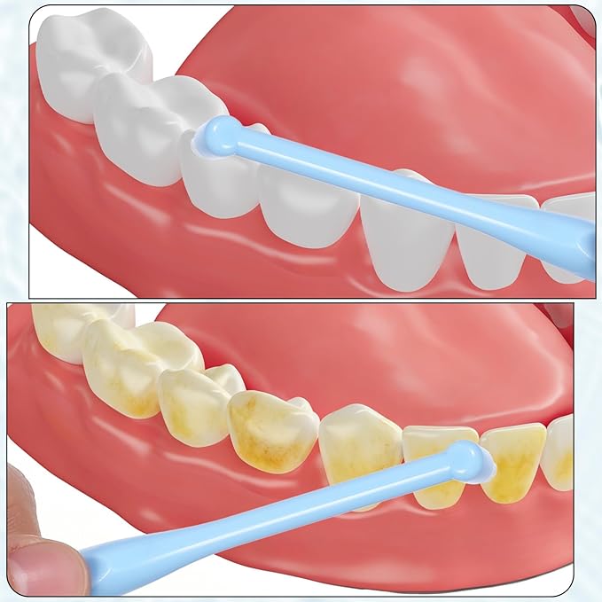 4 PCS End Tuft Toothbrush Adult, Gum Single End Tuft Brush, Soft Orthodontic Toothbrushes for Braces, Small Soft Head for Tiny Hard-to-Reach Areas Detail Cleaning, Individually Wrapped
