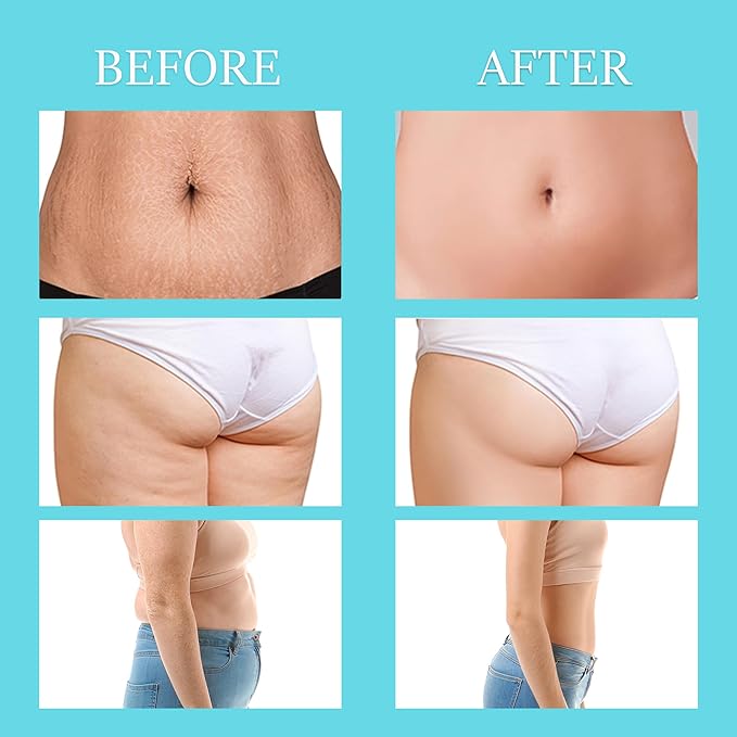 MASIKE Body Machine, Professional Handheld Multifunctional Machine – for Belly, Waist, Arm, Leg, Butt, Ideal Gift for Man&Women