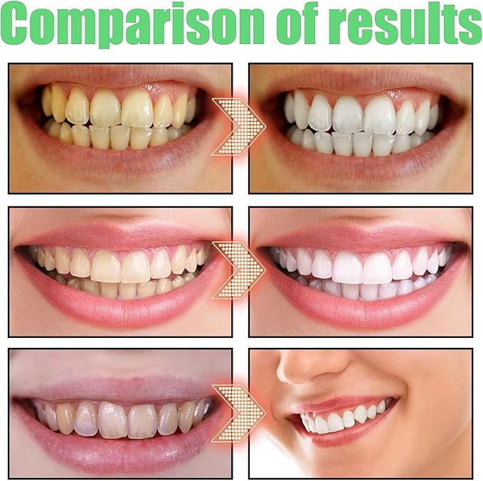 Spearmint Oil Pulling Rinse - Cold-Pressed Coconut Oil mouthwash - Pressed Coconut Mouthwash for Teeth Whitening-for Teeth and Gums, Pure Mouthwash Mint Freshness (1pc)