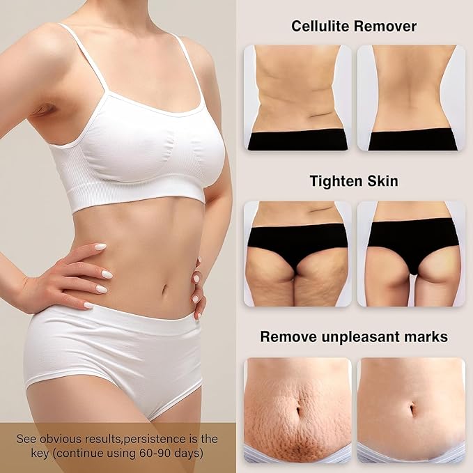 Cellulite Massager, Body Sculpting Tool, Cordless Handheld Body Cellulite Remove for Belly, Fat, Waist, Leg, Butt, Arm - Gifts for Women Mum