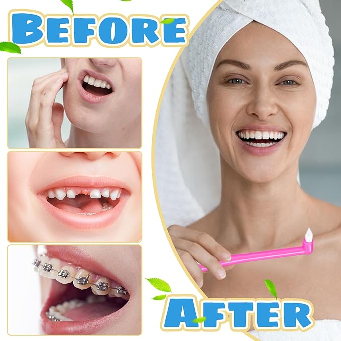 8 Pieces End Tuft Toothbrush with Cover, Soft Interdental Brushes Tapered Brush Braces Toothbrush for Orthodontic Braces Detail Cleaning(Blue/Green/Rose Red/White)