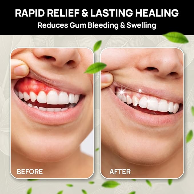 The Goodbye Company Healthy Gum Rinse - Alcohol-Free Natural Mouthwash for Gum Health, Bad Breath & Strong Teeth - Organic Echinacea & Clove Essential Oils - Made in USA - 500ml