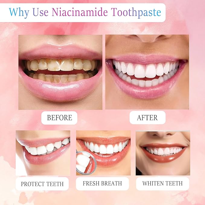 Niacinamide Whitening Toothpaste, Triple White Probiotic Whitening Toothpaste, Fluoride-Free| Sensitivity Relief | Fresh Breath & Stain Removal Formula | Sakura Peach Fragrance (1)