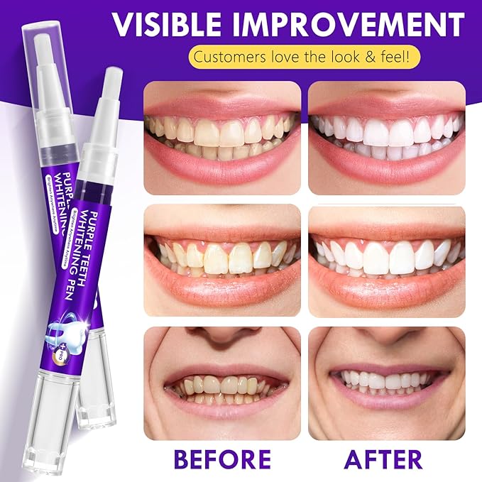 Purple Teeth Whitening Pen, 6PCS Teeth Whitening Gel Essence, Gentle Formula, No Sensitivity Snow Teeth Whitener Gel Kit for a Brighter Smile