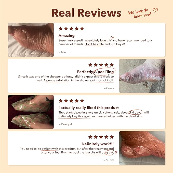 Purederm Exfoliating Foot Mask (3 Pack) – Regular Size Exfoliating Foot Masks for Cracked Feet, Dry Skin, Callused Feet…-StrideForce Fitness