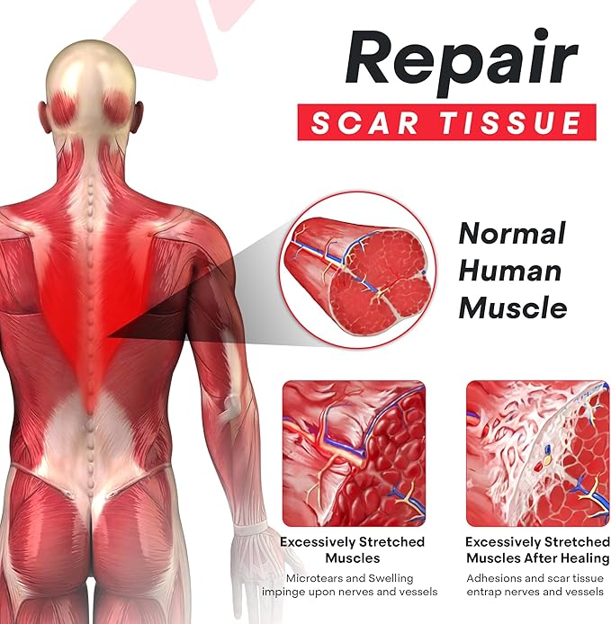 Psoas Muscle Release Tool - Deep Tissue Massager