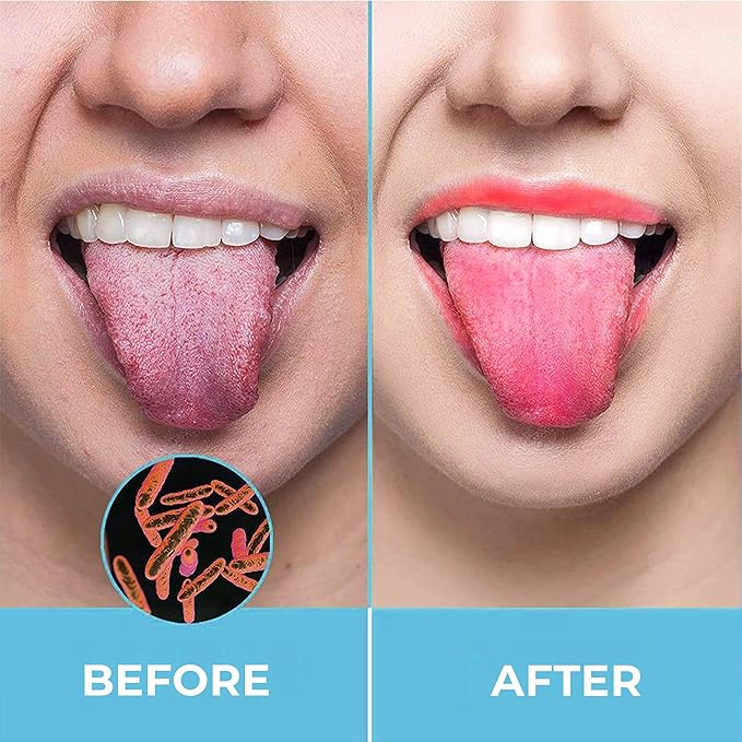 HOKIN Tongue Scraper for Adults with Travel Cases (2Pcs Oral Care Pack) - 100% Metal Spoon Shaped Tongue Cleaners, Tough Scrapers for Oral Hygiene