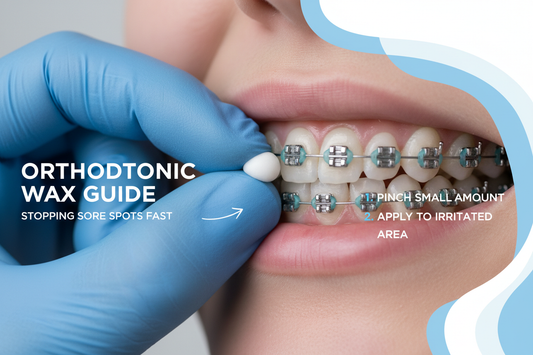 Braces Wax Guide: The Fastest Way to Stop Sore Spots