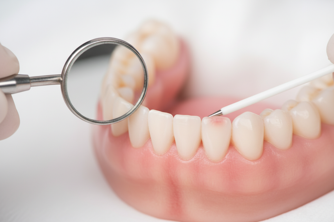 Gum Health Basics: Early Signs You Shouldn't Ignore