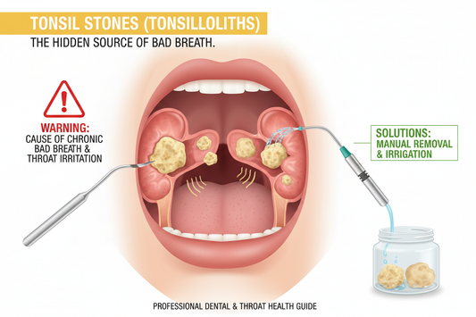 The Hidden Source of Bad Breath: Tonsil Stones and What to Do