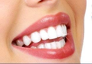 Miracle Brite Smile - Essential Oxygen Rinse Mouthwash for Whiter Teeth, Fresher Breath, and Healthier Gums, Peppermint 12 fl. oz. Our Brand is Reconmended by Dentists.