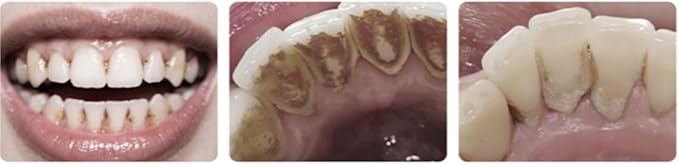 Extra Soft toothbrushes for Adults，Suitable for Sensitive Teeth and People with periodontal Disease,Big and Long Toothbrush Head. 4 Count (Pack of 1)