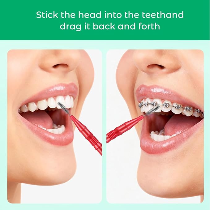 ARTIBETTER 50pcs Interdental Brushes for Braces Floss Brushes for Teeth Toothpick Oral Flossing Head Teeth Cleaning Tool 3mm Red
