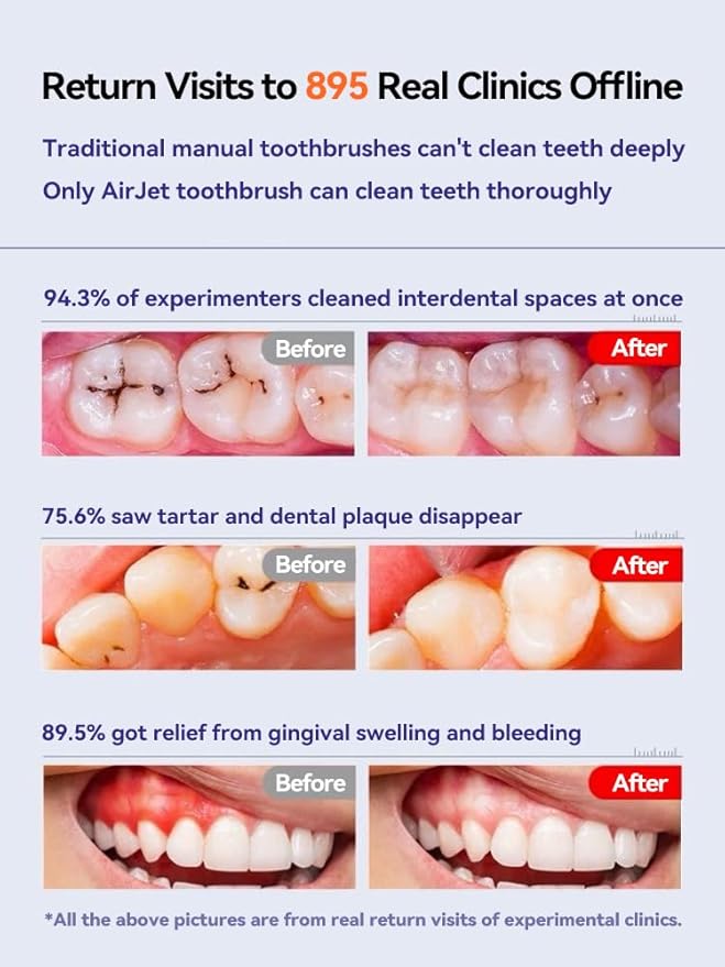 RANVOO AirJet PH3 [Vibrating & Flossing 2-in-1] Bubble Sonic Electric Toothbrush, Plaque Removal, White for Adult Protect Gum Orthodontic Teeth Clean Rechargeable Gift with 2 Soft Brush Heads Grey