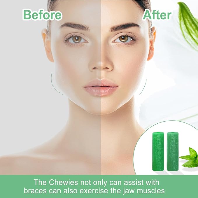 BVN Aligner Chewies, 20 Pieces Orthodontic Chewies with 2 Pieces Aligner Remover Tool, Retainer Chewies, Dental Chewies for Aligners, Orthodontic Dental Chewies Munchies, Green