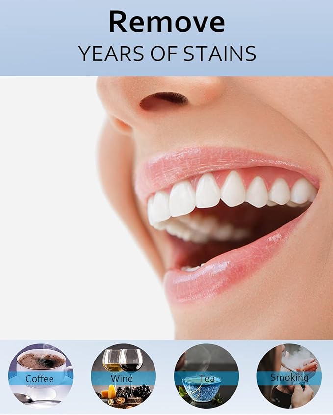 MySmile Teeth Whitening Gel Refills Pack, 6 Non-Sensitive Tooth Whitening Gel for White Teeth, Teeth Whitener Dental Grade Tooth Stain Remover for Tray, 10 min Fast Result Whitening