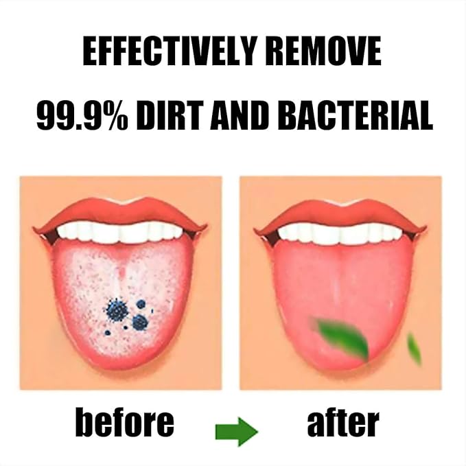 Tongue Brush, Tongue Scraper, Tongue Cleaner, Tongue Scraper Brush, Tongue Cleaner Brush, Tongue Brushes Helps Fight Bad Breath, 3 Tongue Scrapers, 3 Pack (Black & Blue & Green)