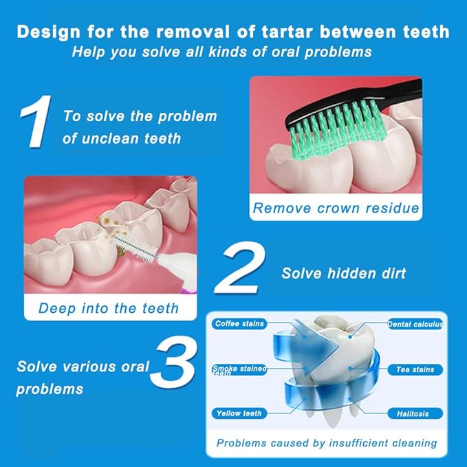 Angzhili 10 pcs Orthodontic Interdental Brush Mini Brush with Toothpick,Tooth Cleaning Tool