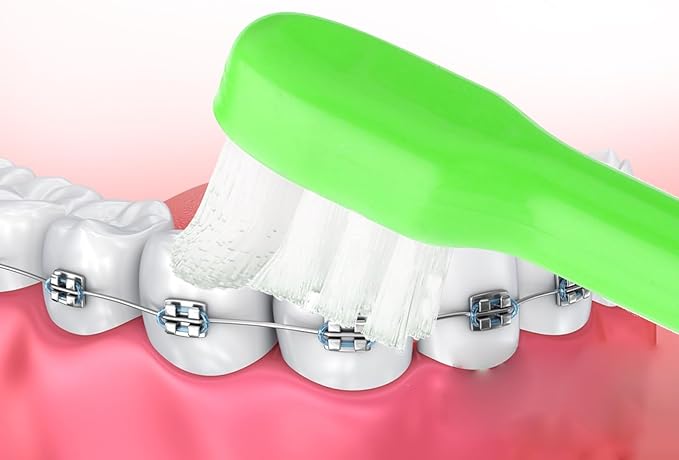 WLLHYF 2 Pieces Tuft Toothbrush Small Head End Tapered Wisdom Interdental Interspace Nursing Soft Tiny Toothbrush Orthodontic Periodontal Dental Products(Green)