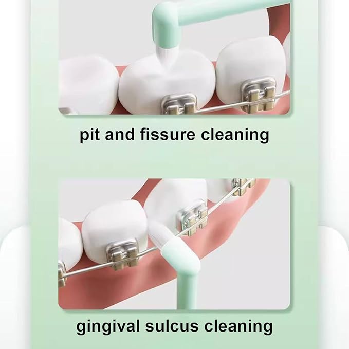 Orthodontic End Tuft Toothbrush, 19x2x1.5cm Soft Precision Brush for Cleaning Between Teeth, Gum Care, Removal, Interdental Cleaning Use