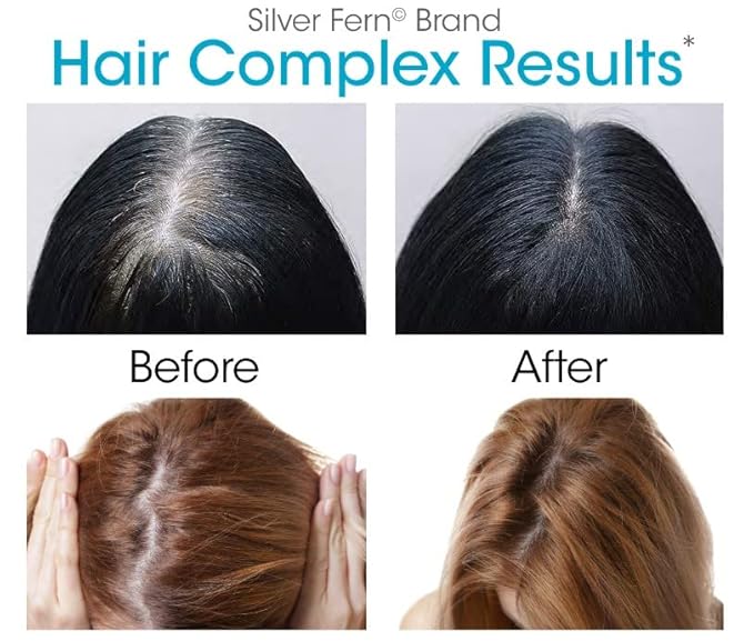 Silver Fern Hair Complex Hair Supplement - Each Bottle Contains a 30-Day Powder Supply - 1 Bottle-StrideForce Fitness