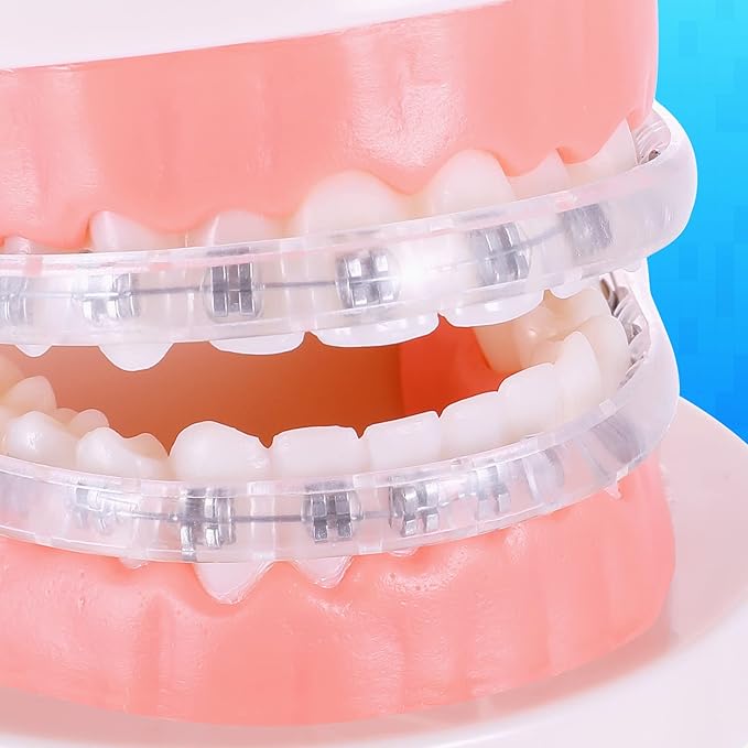 Comfort Covers for Braces - Orthodontic Mouth Guard, Lip Protector, Wax Alternative, Lip Shield for Brackets