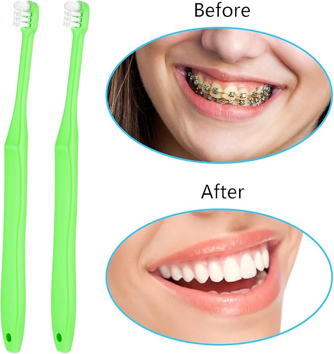 WLLHYF 2 Pieces Tuft Toothbrush Small Head End Tapered Wisdom Interdental Interspace Nursing Soft Tiny Toothbrush Orthodontic Periodontal Dental Products(Green)