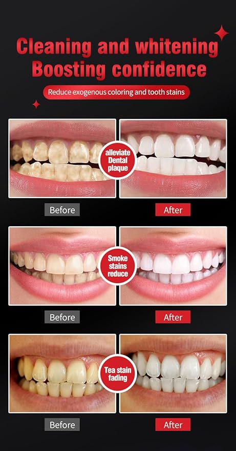 SP-6 Probiotic Toothpaste 2Pcs - Teeth Whitening, Fresh Breath, Plaque Removal & Gum Care, Enamel Safe Formula with Natural Ingredients for Sensitive Teeth, Refreshing Cool Mint Flavor