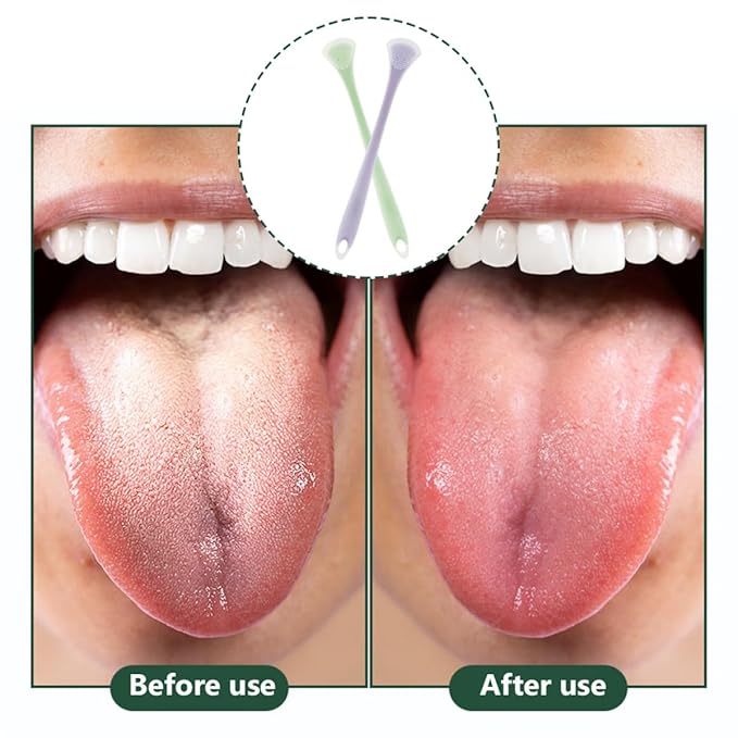2Pcs Silicone Tongue Scraper for Adults and Dual-Sided Tongue Coating Cleaner Portable Oral Care Tool for Breath Freshening and