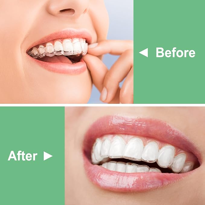 BVN Aligner Chewies, 20 Pieces Orthodontic Chewies with 2 Pieces Aligner Remover Tool, Retainer Chewies, Dental Chewies for Aligners, Orthodontic Dental Chewies Munchies, Green