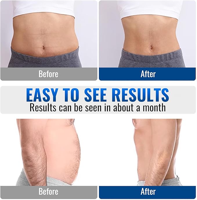 Abs Stimulator, EMS Muscle Stimulator for Gym Home Office, Abdominal Toning Belt Electric Ab Stimulator for Men Women-StrideForce Fitness