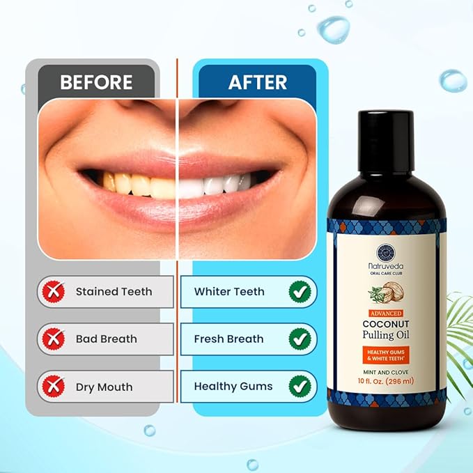Coconut Oil Pulling Mouthwash – 40 oz (Pack of 4), Extra Virgin Coconut Oil, Mint Flavor, Oil Pulling for Teeth & Gums, Natural Mouthwash, Whitening Oral Rinse, Ayurvedic Pulling Oil