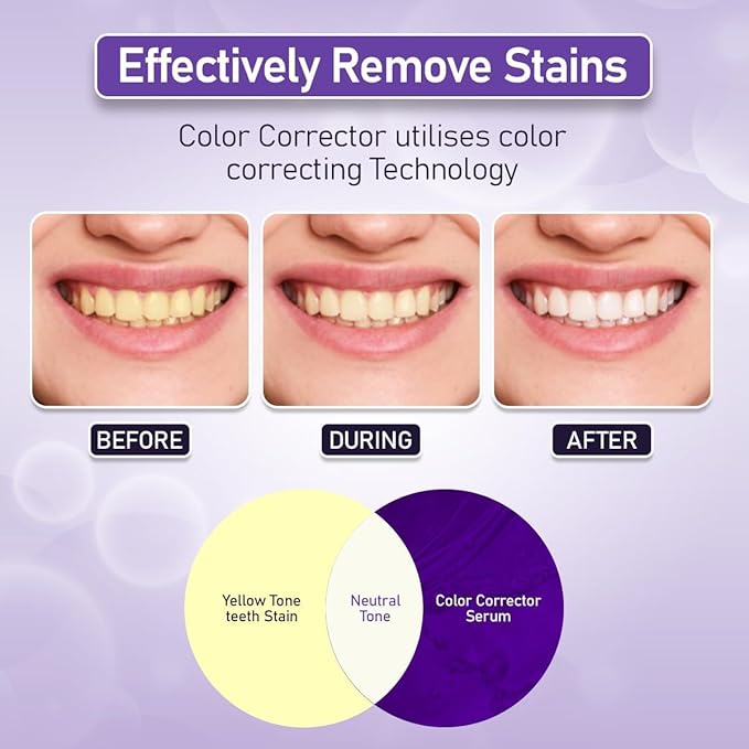ClearerSmile™ Best Purple Toothpaste for Teeth whitening for Sensitive Teeth - Teeth Whitener - blanqueador de dientes