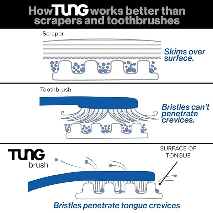 Tung Tongue Cleaning Kit, Tung Brush and Gel, Bad Breath Odor Eliminator, Halitosis Defense, USA Made (Set of 1)