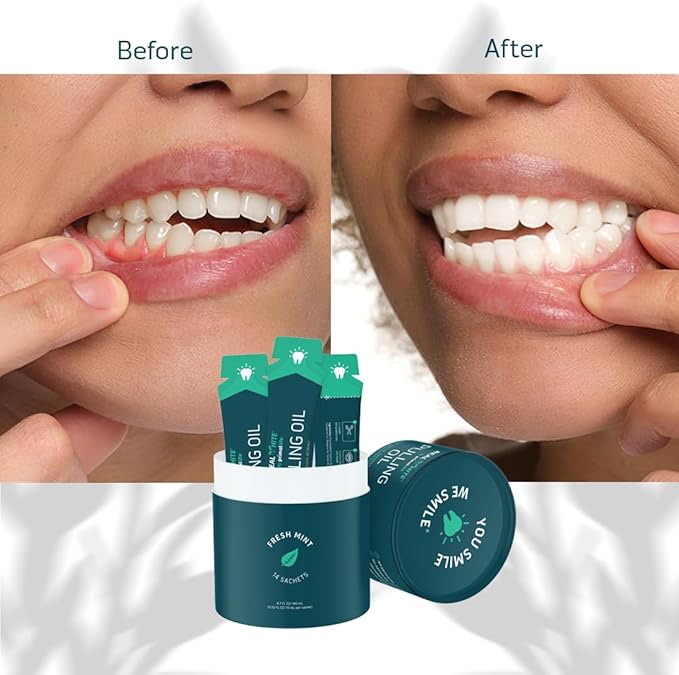 Primal Life Organics – Real White Pulling Oil, Teeth Whitening Mouthwash with Essential Oils, Coconut, Tea Tree, Key Vitamins, Chemical Free, Fluoride Free, 14 Sachets (Fresh Mint, 0.33 oz.)