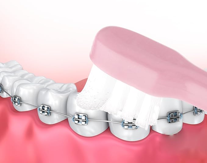 WLLHYF 2 Pieces Tuft Toothbrush Small Head End Tapered Interdental Interspace Nursing Soft Tiny Toothbrush Orthodontic Periodontal Dental Products(Blue + Green)