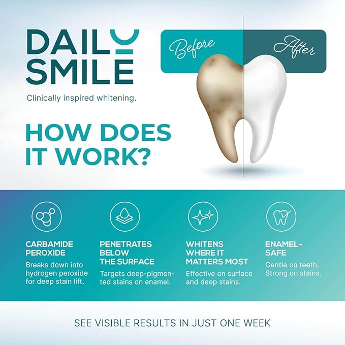 Teeth Whitening Kit with LED - Formulated for Sensitive Teeth, Hands-Free, Waterproof LED Light and 4 Gel Pens, Instant Results