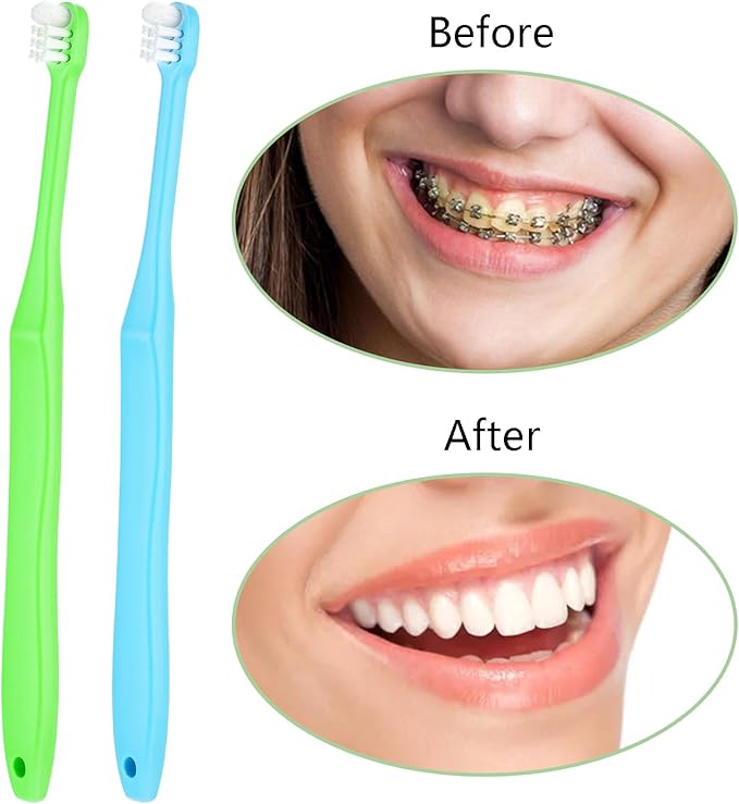 WLLHYF 2 Pieces Tuft Toothbrush Small Head End Tapered Interdental Interspace Nursing Soft Tiny Toothbrush Orthodontic Periodontal Dental Products(Blue + Green)