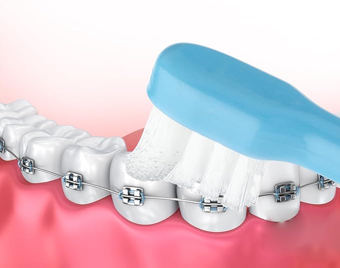 WLLHYF 2 Pieces Tuft Toothbrush Small Head End Tapered Interdental Interspace Nursing Soft Tiny Toothbrush Orthodontic Periodontal Dental Products(Blue + Green)