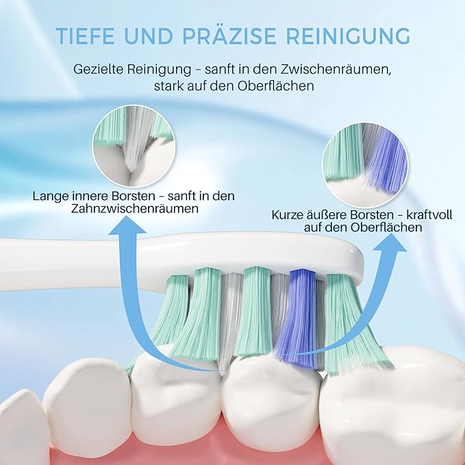 PERECT Soft Replacement Toothbrush Heads 12-Pack for Philips Sonicare Click-On Models – Fits 4100, 5100, 6100, 9023, W Optimal Plaque Control, Not Compatible with Essence/E-Series or Philips One