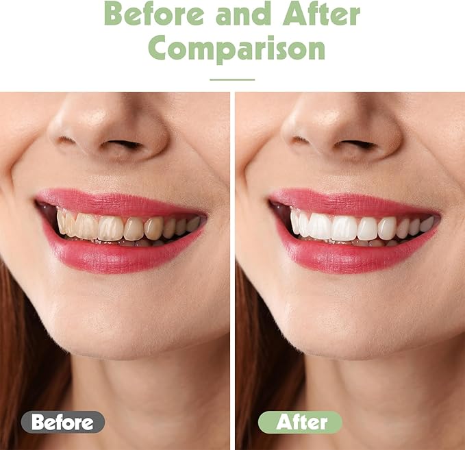 6pcs Travel Toothbrush Set, Extra Soft Toothbrushes for Adults Gentle Portable Manual Toothbrush with Individual Travel Case Deep Cleaning Flossing Toothbrushes for Sensitive Teeth(Multicolor)