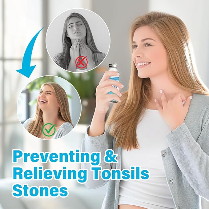 Tonsil Stone Remover Mouthwash - Alcohol-Free Oral Rinse to Soothe Tonsils and Combat Bad Breath, 4 Fl Oz