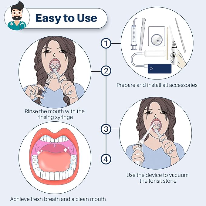 Voraiya Tonsil Stone Remover, Electronic Vacuum Tonsil Stone Removal Kit, 8 Suction Mode, Built-in LED Light, Fight Bad Breath, Oral Irrigator, Tonsil Cleaner, Tongue Scraper (White)