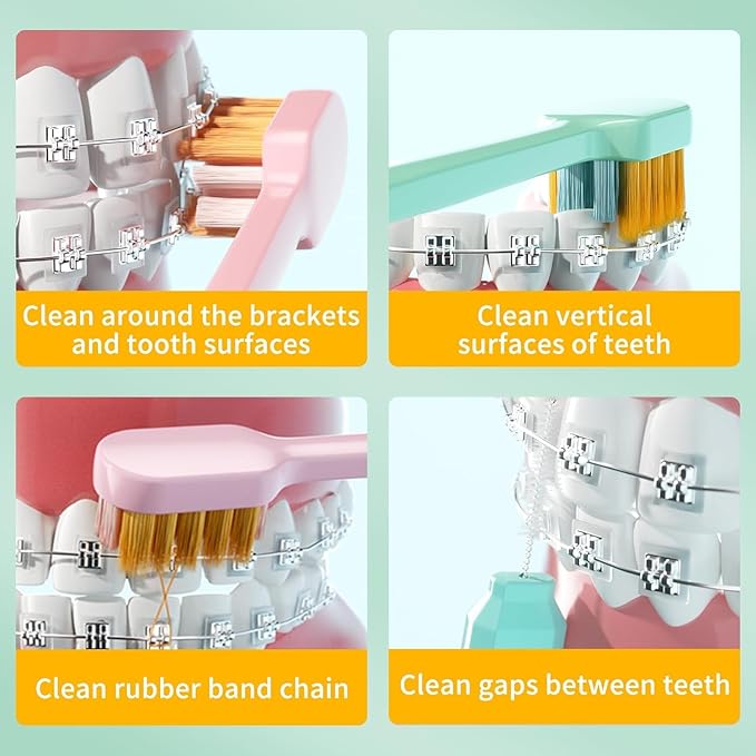 Y-Kelin 2IN1 Orthodontic Braces Toothbrush with interdental Brush