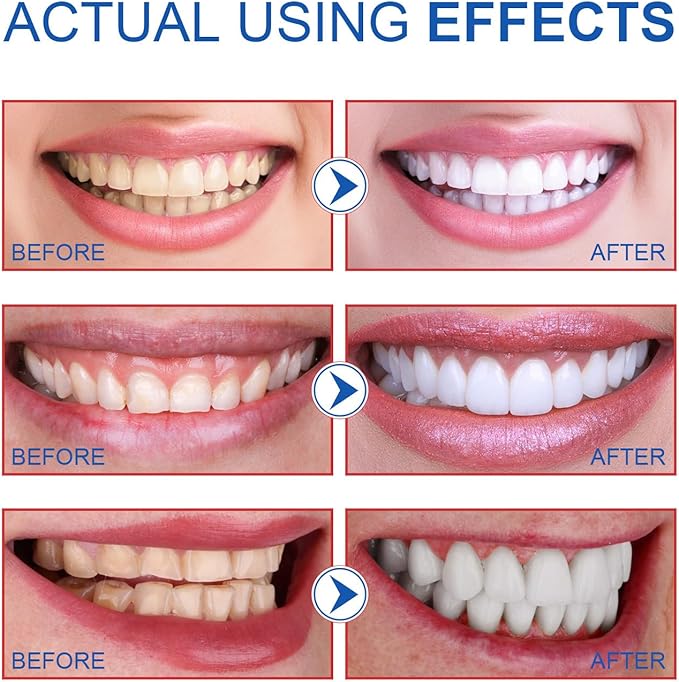 2PCS SP-6 Toothpaste, SP6 Probiotic Toothpaste, Fresh Breath, Deep Cleaning Care