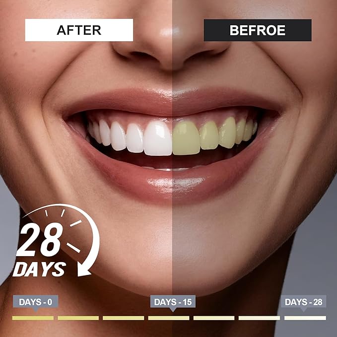 woadee 7.5% Hydroxyapatite Toothpaste for Advanced Enamel Protection, Fluoride-Free Nano Hydroxyapatite Toothpaste, Gentle and Effective Formula, Fresh Breath, Suitable for Sensitive Teeth 2 Pack