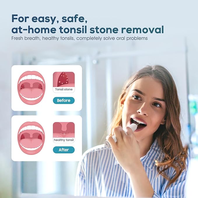 Tonsil Stone Remover Kit,3 Modes Electronic Tonsil Stone Remover Vacuum,Oral Irrigator for Best Tonsil Stone Remover LED Light,Tonsil Stone Mouthwash 5X Magnifying Mirror,Fight Bad Breath Tonsil Stone