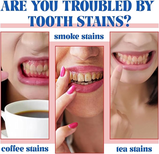 2PCS SP-6 Toothpaste, SP6 Probiotic Toothpaste, Fresh Breath, Deep Cleaning Care