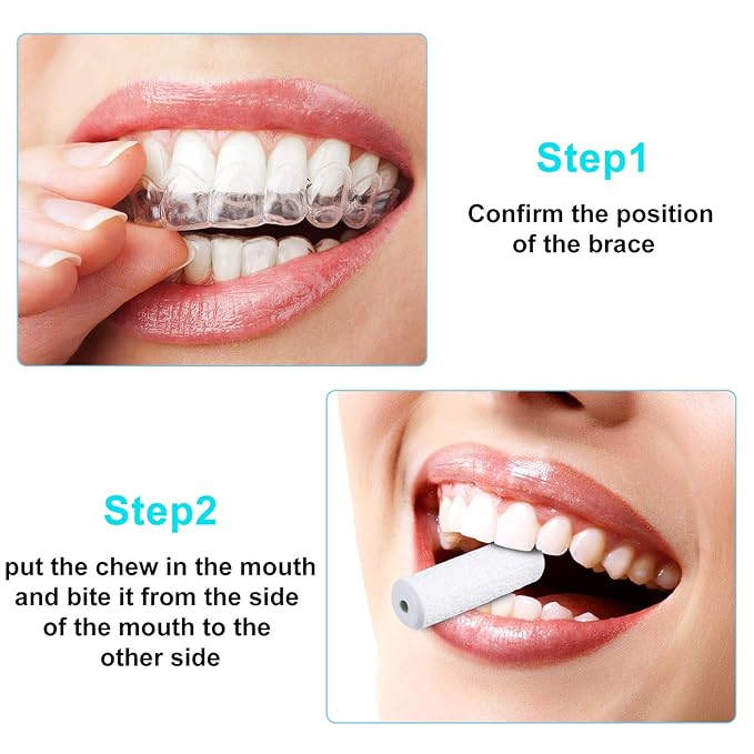 20 Pieces Aligner Tray Seaters for Aligner Trays Chompers Orthodontic Trays(Pink, Orange, Green, Purple, White)